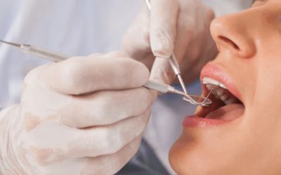 VA Dental Benefits and Disability Ratings For Teeth