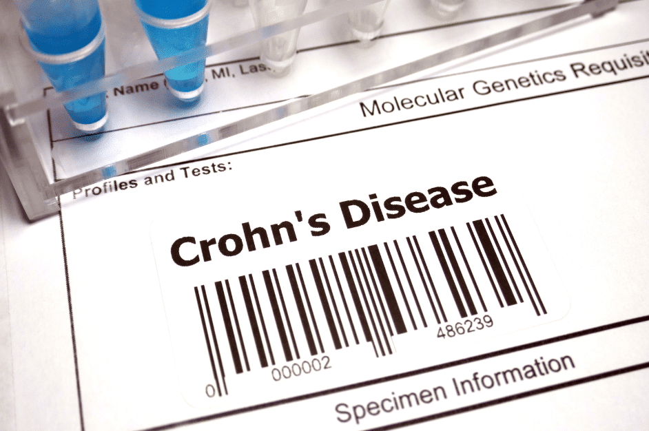 Can I Get VA Disability for Crohn’s Disease?