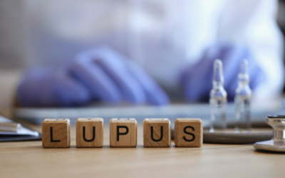 VA Disability Ratings for Lupus