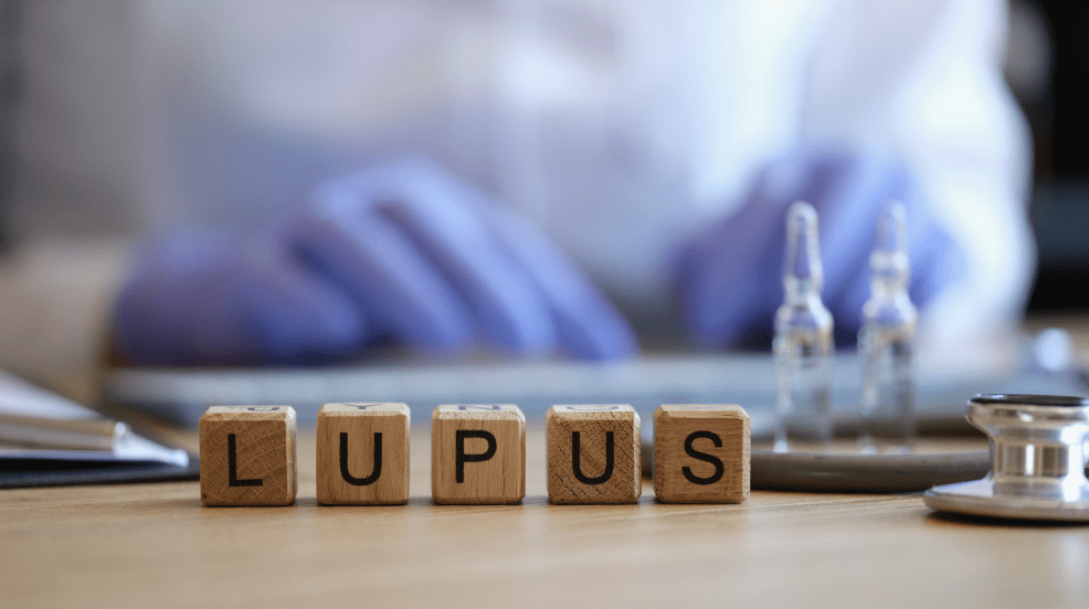 VA Disability Ratings for Lupus