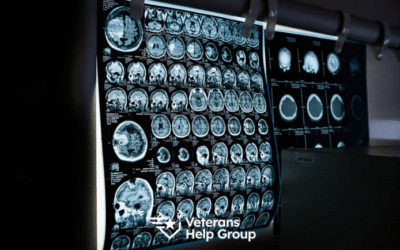 How to Get a 100% VA Disability Rating for TBI (Traumatic Brain Injury) – Veterans Help Group