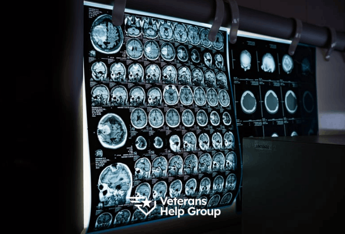How to Get a 100% VA Disability Rating for TBI (Traumatic Brain Injury) – Veterans Help Group